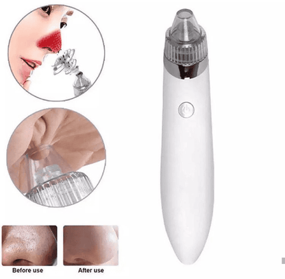 Blackheads Remover Vacuum Suction, Blackhead Removal Machine,  Deeply Facial Cleaning Tool