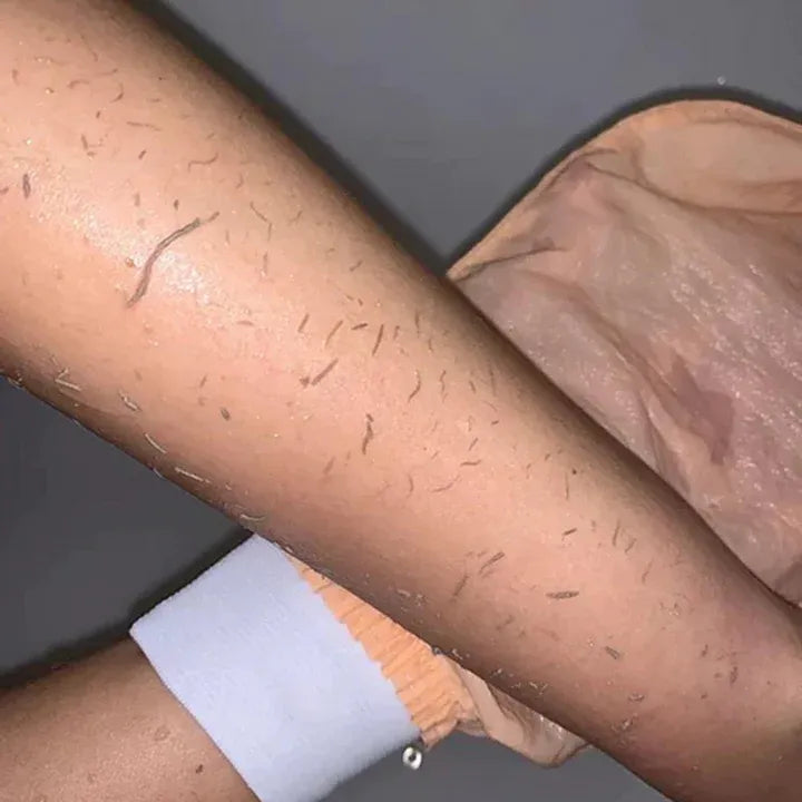 Deep Exfoliating Mitt Glove – Intense Dead Skin Removal