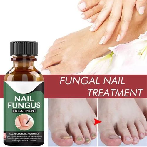 Fast Nail Fungal Treatment Gel